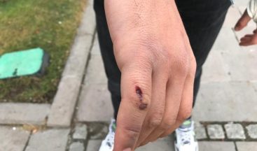 “Canım acıdı” denilerek darp edilen sağlıkçı o anları anlattı