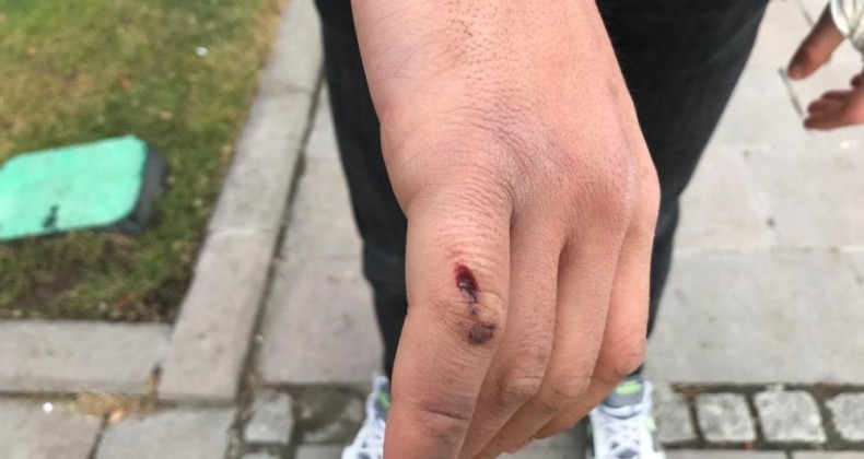 “Canım acıdı” denilerek darp edilen sağlıkçı o anları anlattı