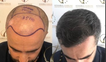 İstanbul Hairline CEO’su Gülşen Şener: “Çalışanlarımızı düzenli aralıklarla PCR testinden geçiriyoruz”