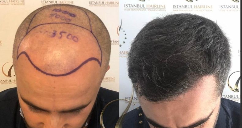 İstanbul Hairline CEO’su Gülşen Şener: “Çalışanlarımızı düzenli aralıklarla PCR testinden geçiriyoruz”